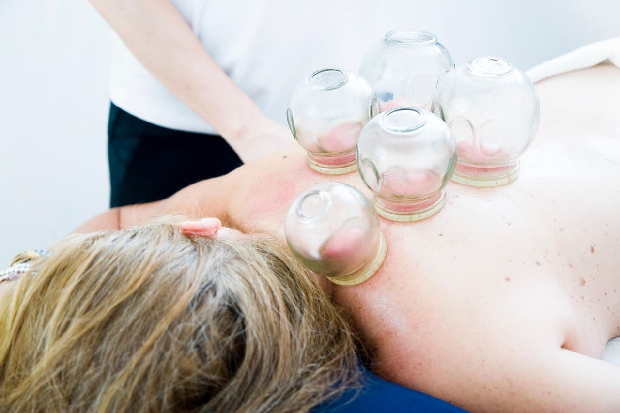 Dynamic Cupping Therapy